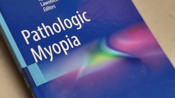 Dr. Spaides Second Edition of Pathologic Myopia