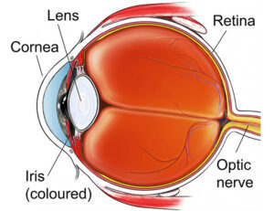 Glaucoma Specialists - Laser Surgery for Glaucoma in New York