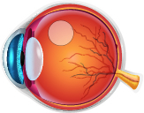 Central Serous Chorioretinopathy