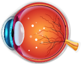 Diabetic Retinopathy