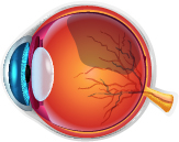 Retinal Tears Detachments